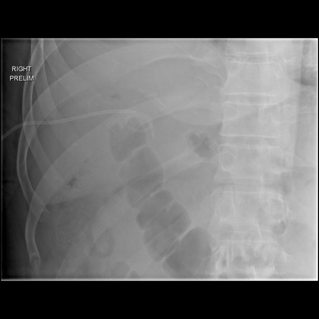 Radiology Quiz 32823 | Radiopaedia.org