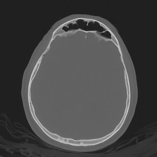 Multitrauma: intracranial, spinal, thoracic and pelvic injuries | Image ...