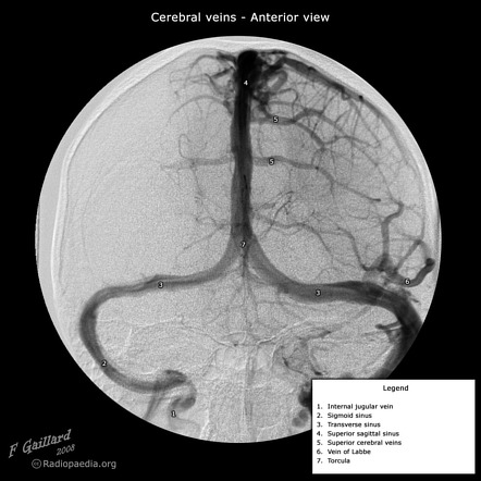 The larger superficial cerebral veins, including those draining the