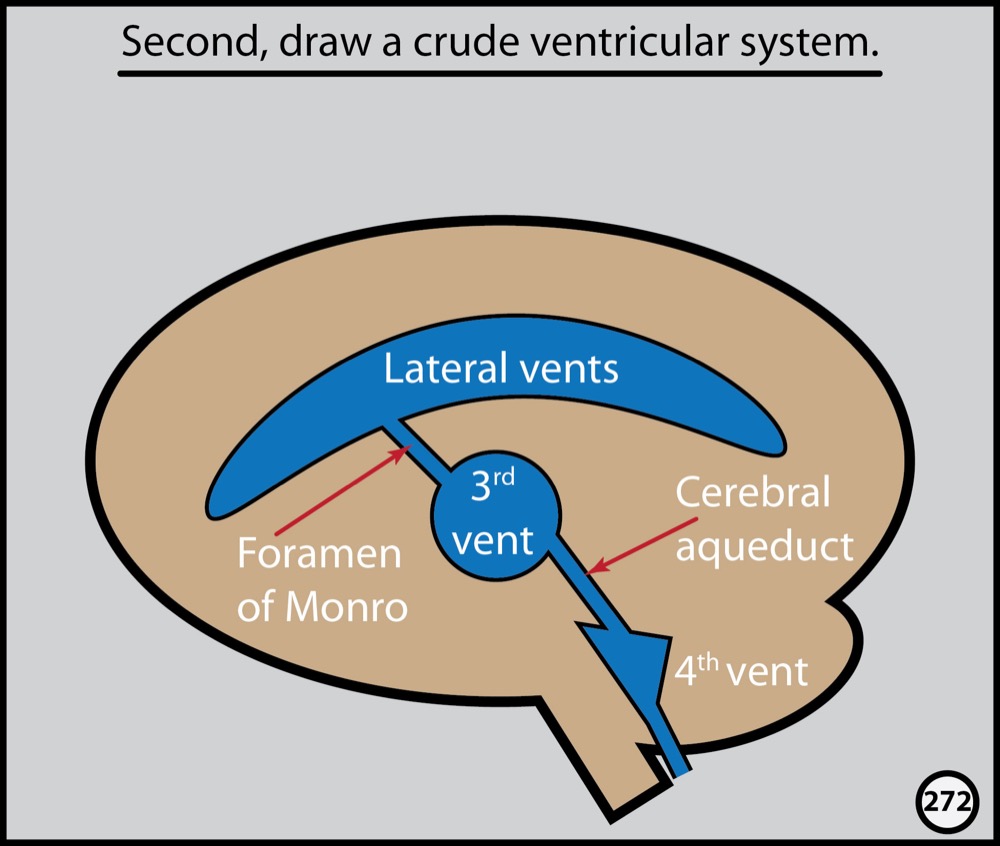 Head CT: The Graphic Novel | Radiopaedia.org