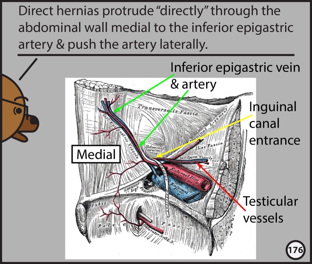 Abdominopelvic CT: The Graphic Novel | Radiopaedia.org