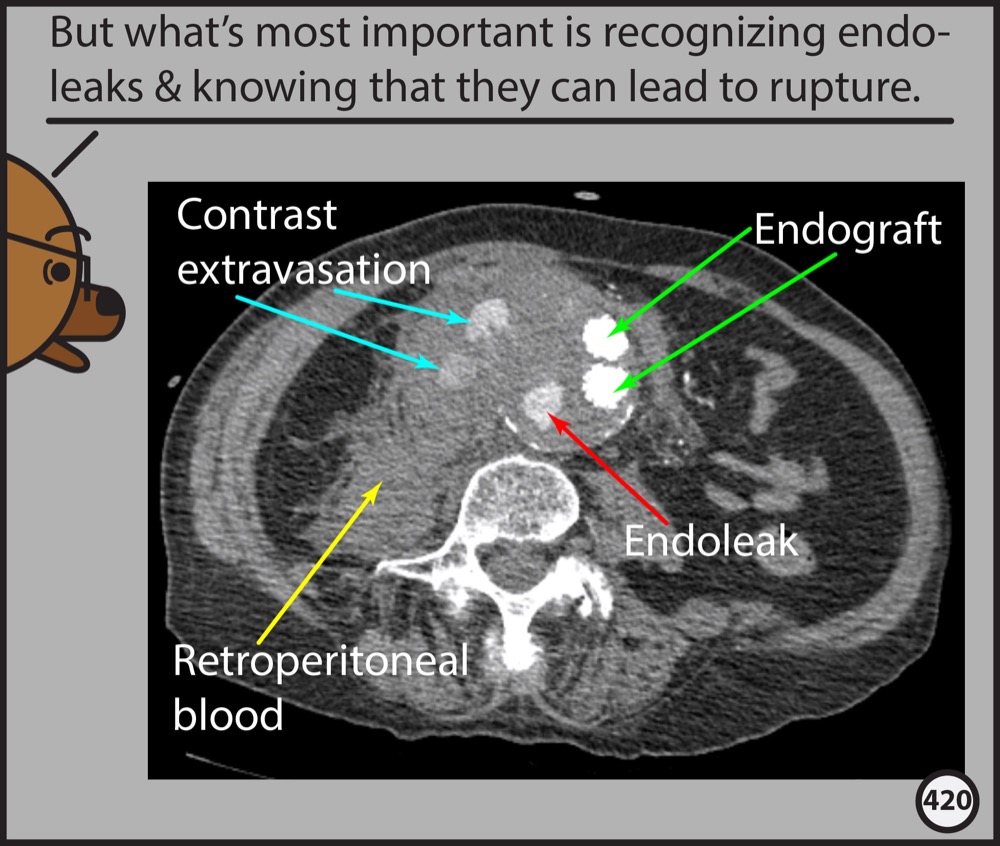 Abdominopelvic Ct: The Graphic Novel 