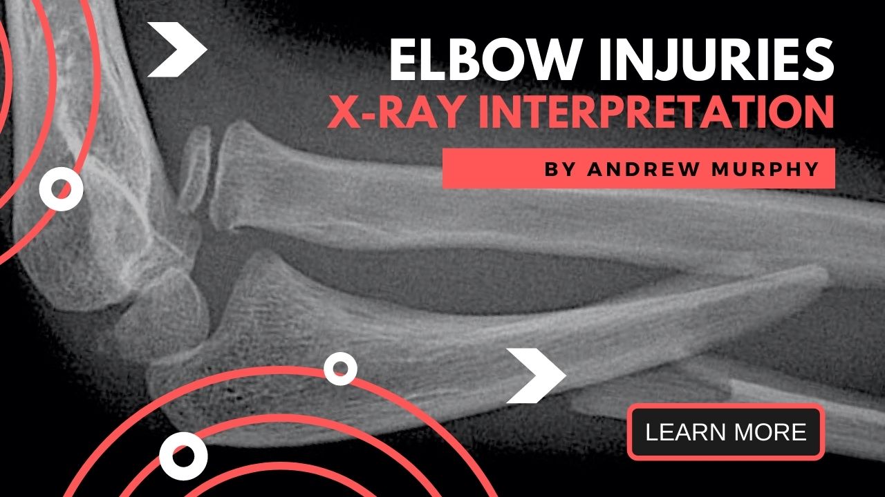 Trauma Elbow X Ray Positioning