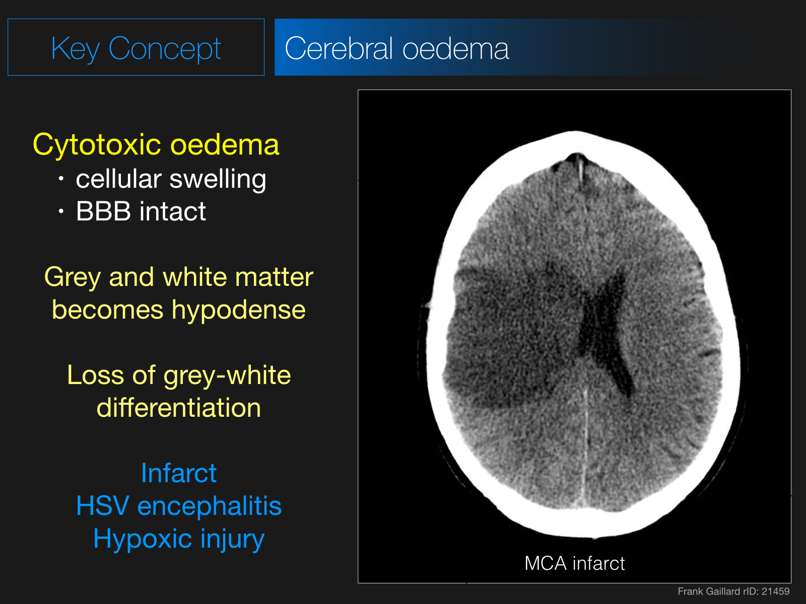 oedema-quiz-oedema-in-which-part-of-the-body-first-if-anasarka