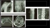 Playlist 'FRCR Companion- Metabolic bone disease ' by Mehak un nisa ...