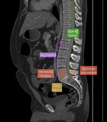 Viewing Playlist Spine Radiopaedia Org