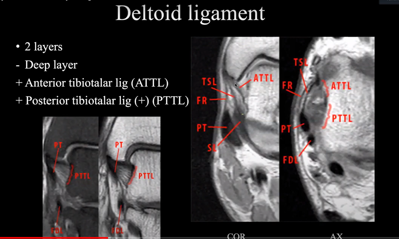 Radiology Quiz Radiopaedia Org Playlist Ankle Mri By Dr Ng Thanh Van Anh