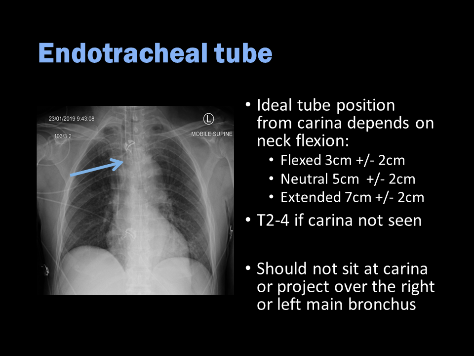 Radiology Quiz 137526 | Radiopaedia.org | Playlist 'Intern education ...