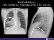 Viewing playlist: Pediatric Radiology - Pitt Med Students | Radiopaedia.org